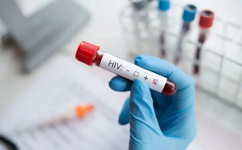 З початку року в Україні зафіксували понад 2 тисячі нових випадків ВІЛ